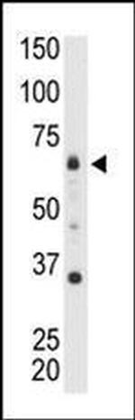 MTMR8 Antibody in Western Blot (WB)