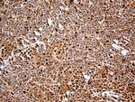 MTOR Antibody in Immunohistochemistry (Paraffin) (IHC (P))