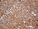 MTOR Antibody in Immunohistochemistry (Paraffin) (IHC (P))