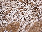 MTOR Antibody in Immunohistochemistry (Paraffin) (IHC (P))