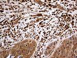 MTOR Antibody in Immunohistochemistry (Paraffin) (IHC (P))
