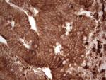 MTOR Antibody in Immunohistochemistry (Paraffin) (IHC (P))