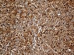 MTOR Antibody in Immunohistochemistry (Paraffin) (IHC (P))