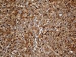 MTOR Antibody in Immunohistochemistry (Paraffin) (IHC (P))