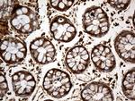 MTOR Antibody in Immunohistochemistry (Paraffin) (IHC (P))