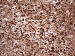 MTOR Antibody in Immunohistochemistry (Paraffin) (IHC (P))