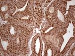 MTOR Antibody in Immunohistochemistry (Paraffin) (IHC (P))