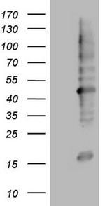 MTOR Antibody in Western Blot (WB)