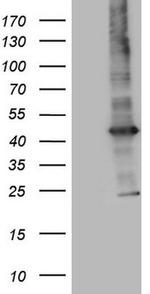MTOR Antibody in Western Blot (WB)
