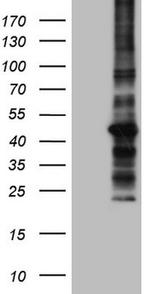 MTOR Antibody in Western Blot (WB)