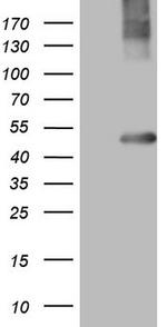 MTOR Antibody in Western Blot (WB)