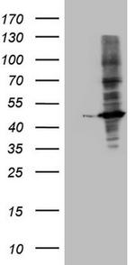 MTOR Antibody in Western Blot (WB)