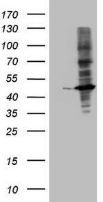 MTOR Antibody in Western Blot (WB)
