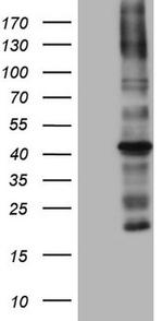 MTOR Antibody in Western Blot (WB)