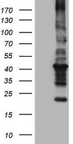 MTOR Antibody in Western Blot (WB)