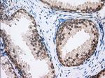 MTRF1L Antibody in Immunohistochemistry (Paraffin) (IHC (P))