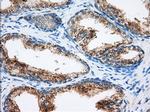 MTRF1L Antibody in Immunohistochemistry (Paraffin) (IHC (P))
