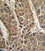 MTTP Antibody in Immunohistochemistry (IHC)