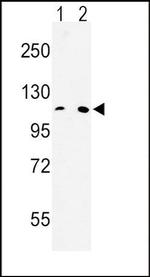 MTTP Antibody in Western Blot (WB)