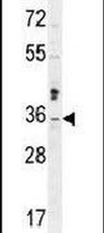 MTX2 Antibody in Western Blot (WB)