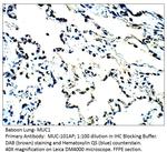 MUC1 Polyclonal Antibody