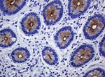 MUC1 Antibody in Immunohistochemistry (Paraffin) (IHC (P))