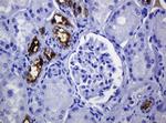 MUC1 Antibody in Immunohistochemistry (Paraffin) (IHC (P))