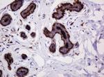 MUC1 Antibody in Immunohistochemistry (Paraffin) (IHC (P))