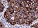MUC1 Antibody in Immunohistochemistry (Paraffin) (IHC (P))