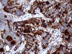MUC1 Antibody in Immunohistochemistry (Paraffin) (IHC (P))