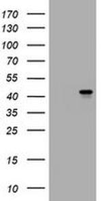 MUC16 Antibody in Western Blot (WB)