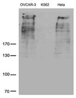 MUC16 Antibody in Western Blot (WB)