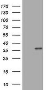 MUC16 Antibody in Western Blot (WB)