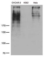 MUC16 Antibody in Western Blot (WB)
