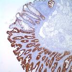 MUC2 Antibody in Immunohistochemistry (IHC)