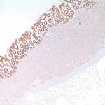 MUC5AC Antibody in Immunohistochemistry (IHC)