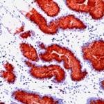 MUC5AC Antibody in Immunohistochemistry (IHC)