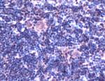 IRF4 Antibody in Immunohistochemistry (IHC)