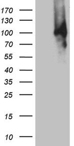 MUM1 Antibody in Western Blot (WB)