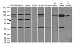 MUS81 Antibody in Western Blot (WB)