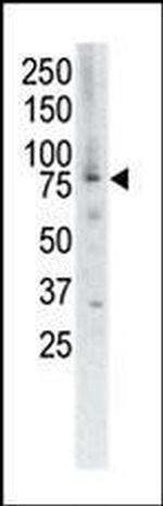 MUSK Antibody in Western Blot (WB)