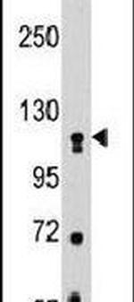 MUSK Antibody in Western Blot (WB)