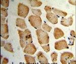 MVD Antibody in Immunohistochemistry (IHC)
