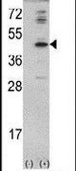 MVD Antibody in Western Blot (WB)