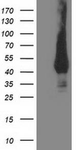 MVK Antibody in Western Blot (WB)