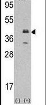 MVK Antibody in Western Blot (WB)