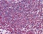 MYADM Antibody in Immunohistochemistry (IHC)