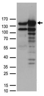 MYBBP1A Antibody in Western Blot (WB)