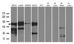 MYBBP1A Antibody in Western Blot (WB)