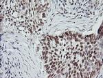 MYBPH Antibody in Immunohistochemistry (Paraffin) (IHC (P))
